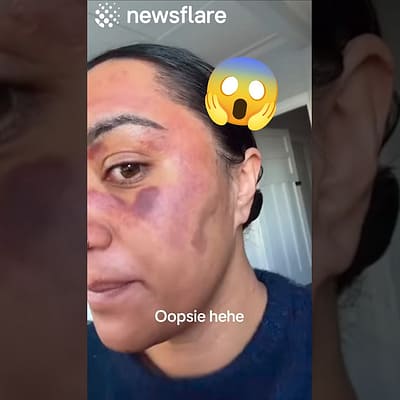 Skincare Routine Turns Into Disaster