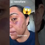 Skincare Routine Turns Into Disaster
