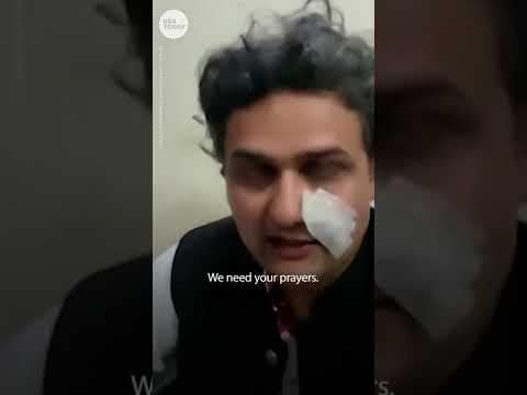 Imran Khan, ex-prime minister of Pakistan, shot at campaign rally | USA TODAY #Shorts