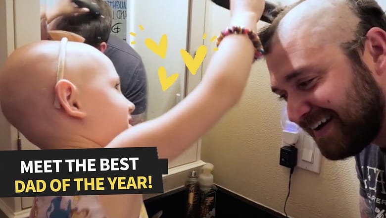 Meet the Man Who Shaves His Head to Support his Daughter with Alopecia