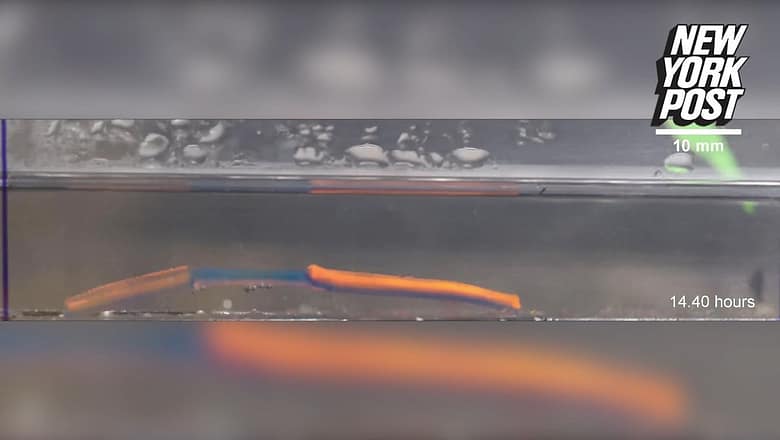 Creepy-crawly gel robots being trained to root out disease in body | New York Post