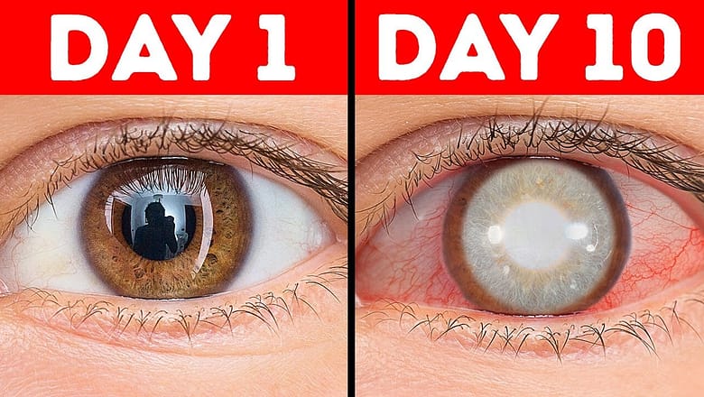 What Happens If You Don’t Blink