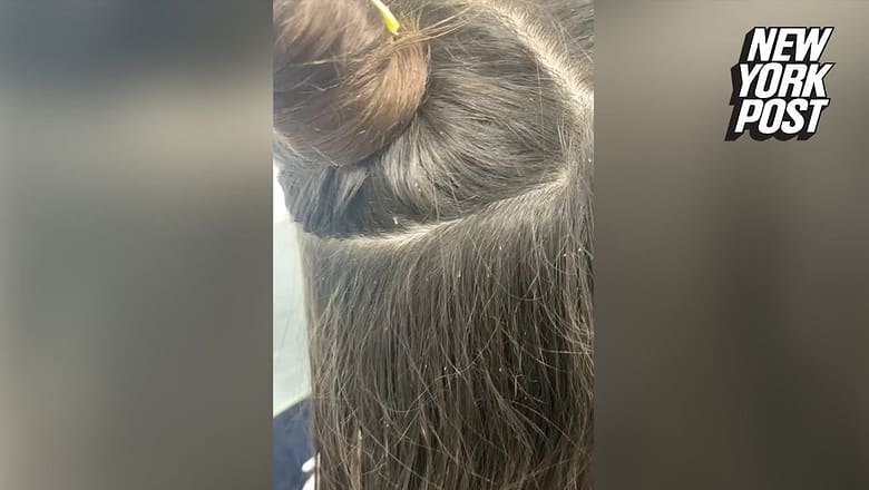 I’m a hairdresser and I found a 150-egg lice infestation in my client’s hair | New York Post
