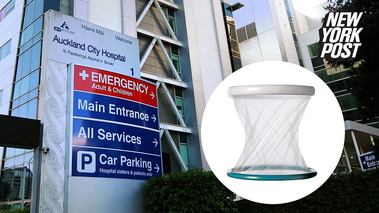 Dinner plate-size surgical tool found inside woman’s body 18 months after C-section