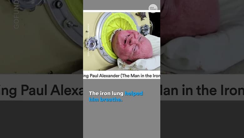 Man living in iron lung after he contracted polio in 1952 dies #Shorts