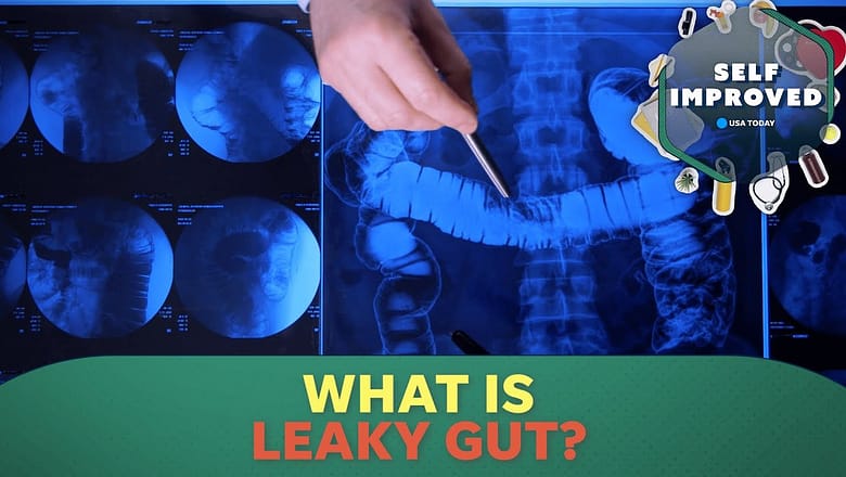 Expert explains how leaky gut can increase the risk of cancer | SELF IMPROVED